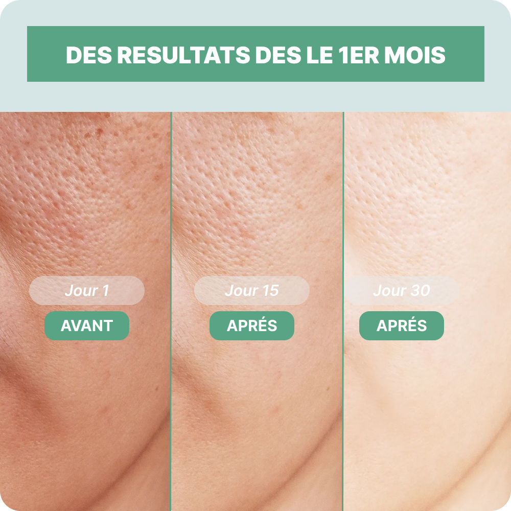 Acide Hyaluronique & Collagène