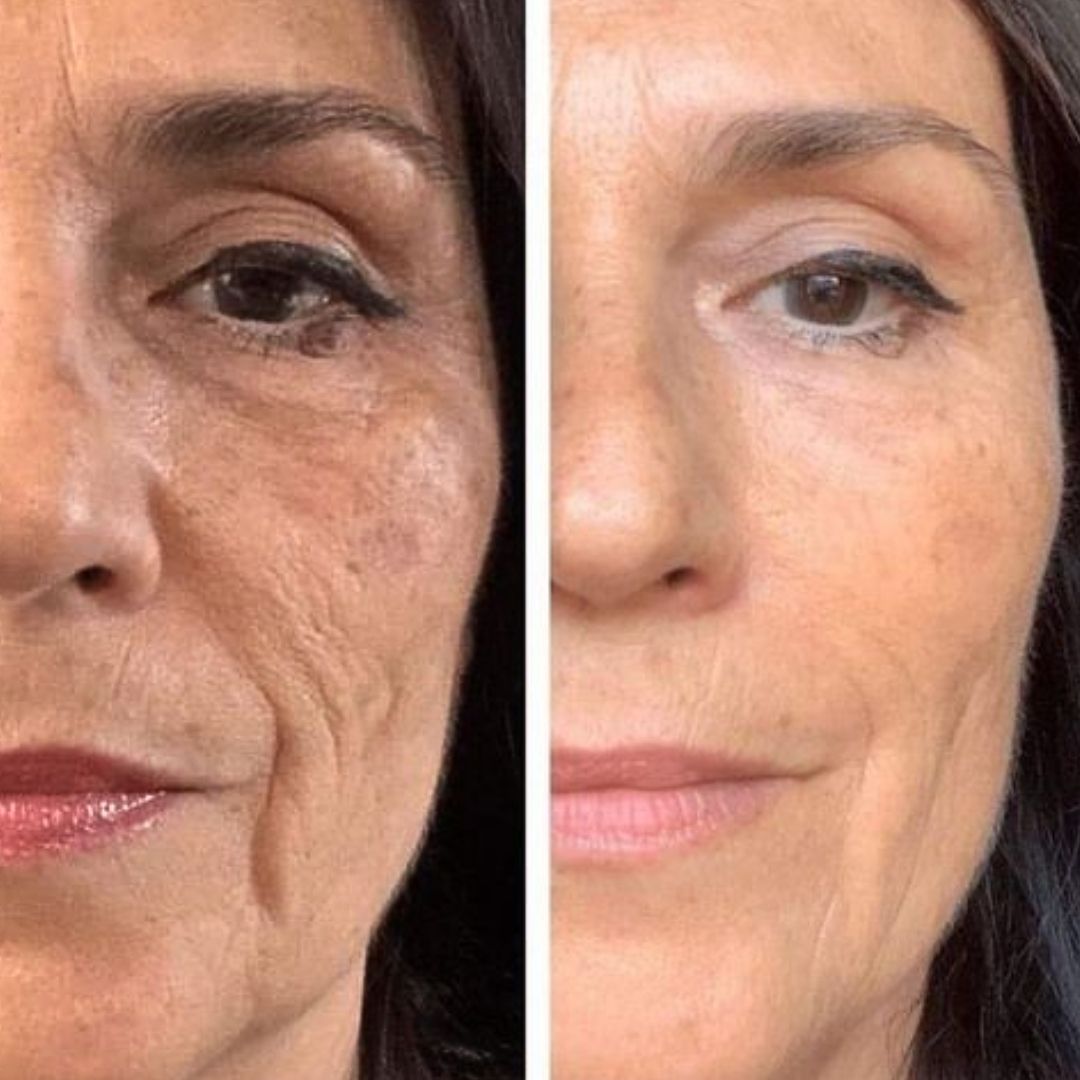 Cure Anti-age - Peau Parfaite